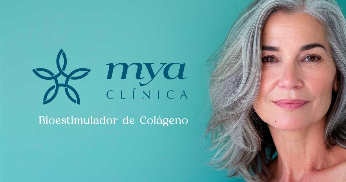 tratamento com bioestimulador de colágeno