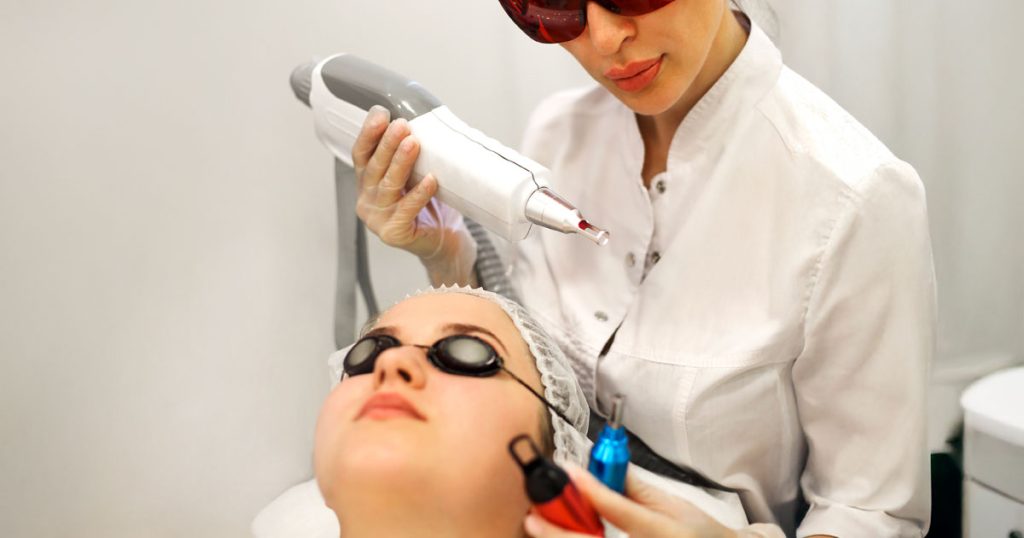 Remover a Micropigmentação das Sobrancelhas com Laser