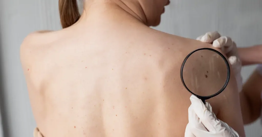 dermatologista algarve